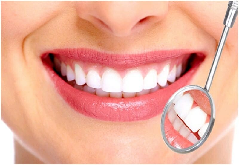 Răng sứ Zirconia và 5 lưu ý khi bọc răng sứ 1