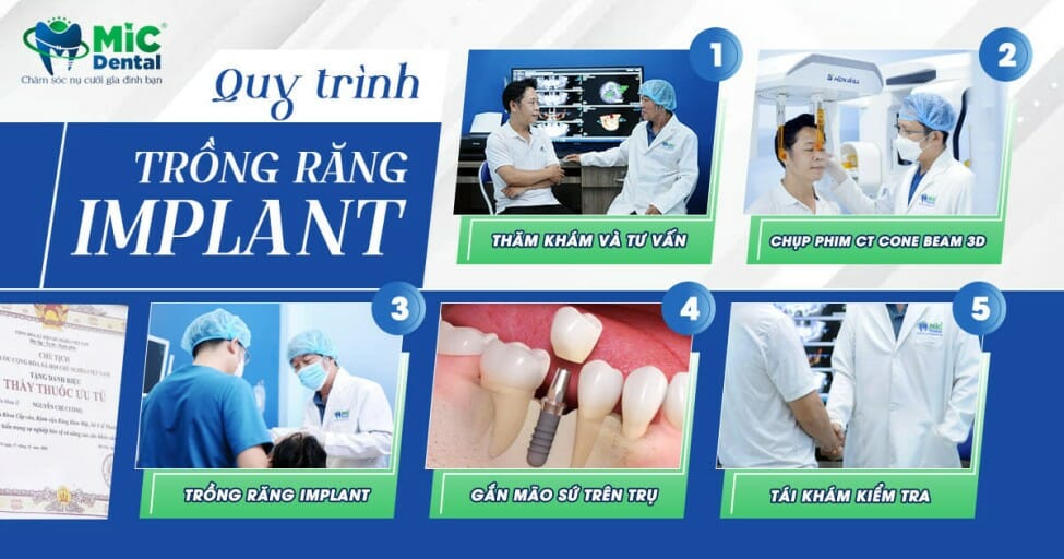 Quy trình cấy ghép răng diễn ra như thế nào?