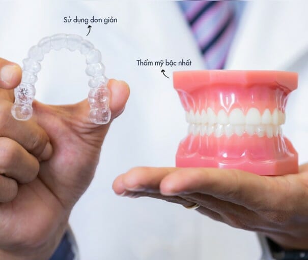 Niềng răng trong suốt giá bao nhiêu? 3 ưu điểm vượt trội 2