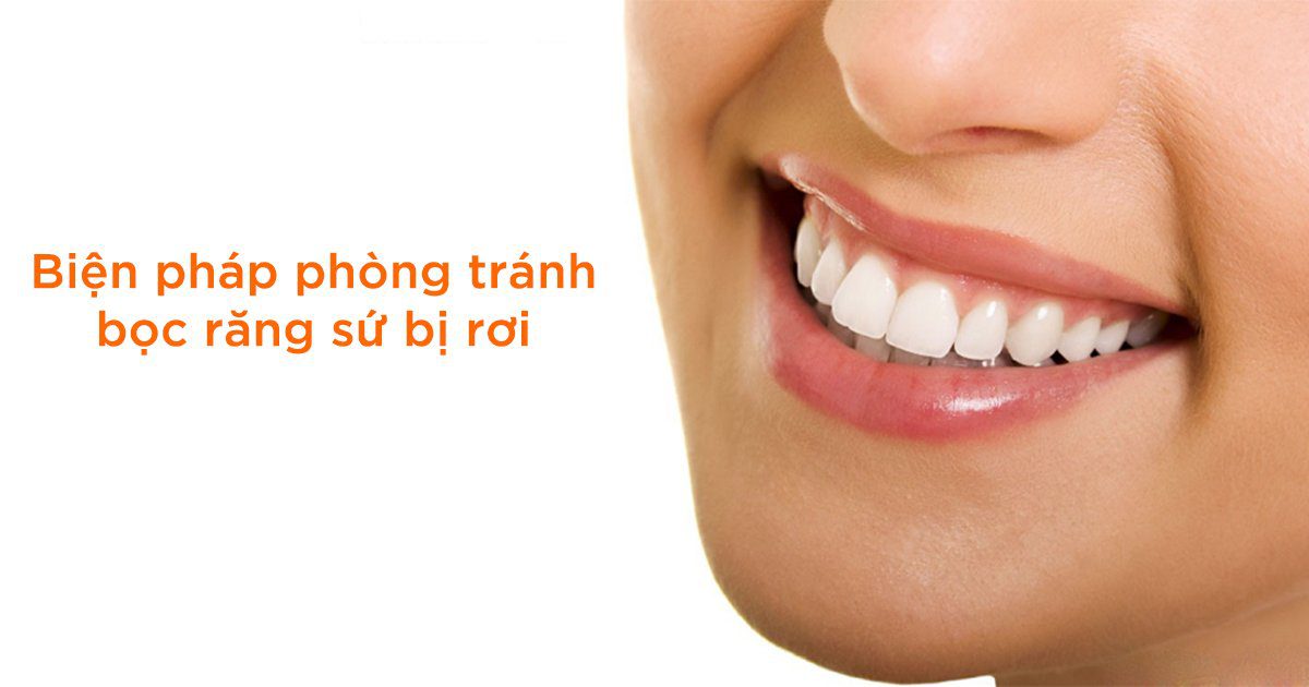 Bọc răng sứ có bị rơi ra không? Nguyên nhân và cách khắc phục 5