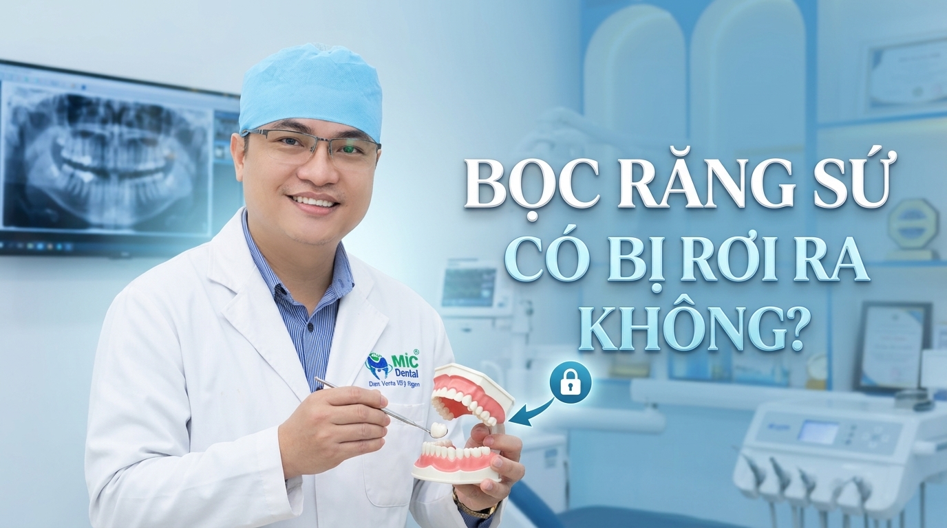Bọc răng sứ có bị rơi ra không? Nguyên nhân và cách khắc phục