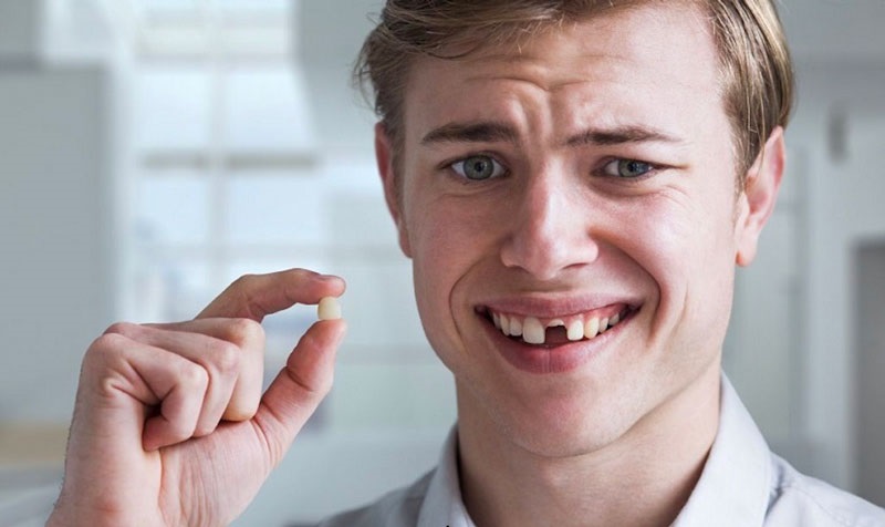 Mất răng cửa phải làm sao? Cách khắc phục thẩm mỹ và an toàn nhất 8