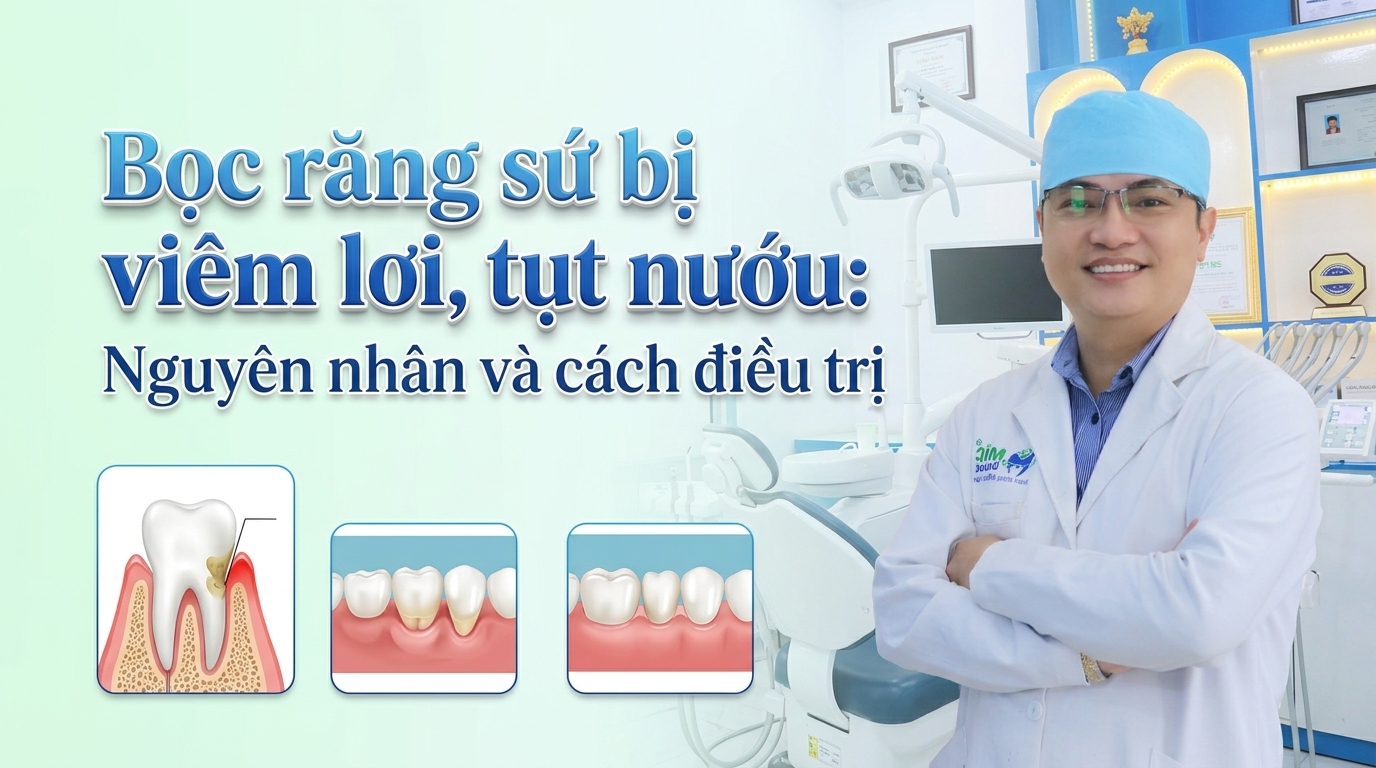 Bọc răng sứ bị viêm lợi, tụt nướu: Nguyên nhân và cách điều trị