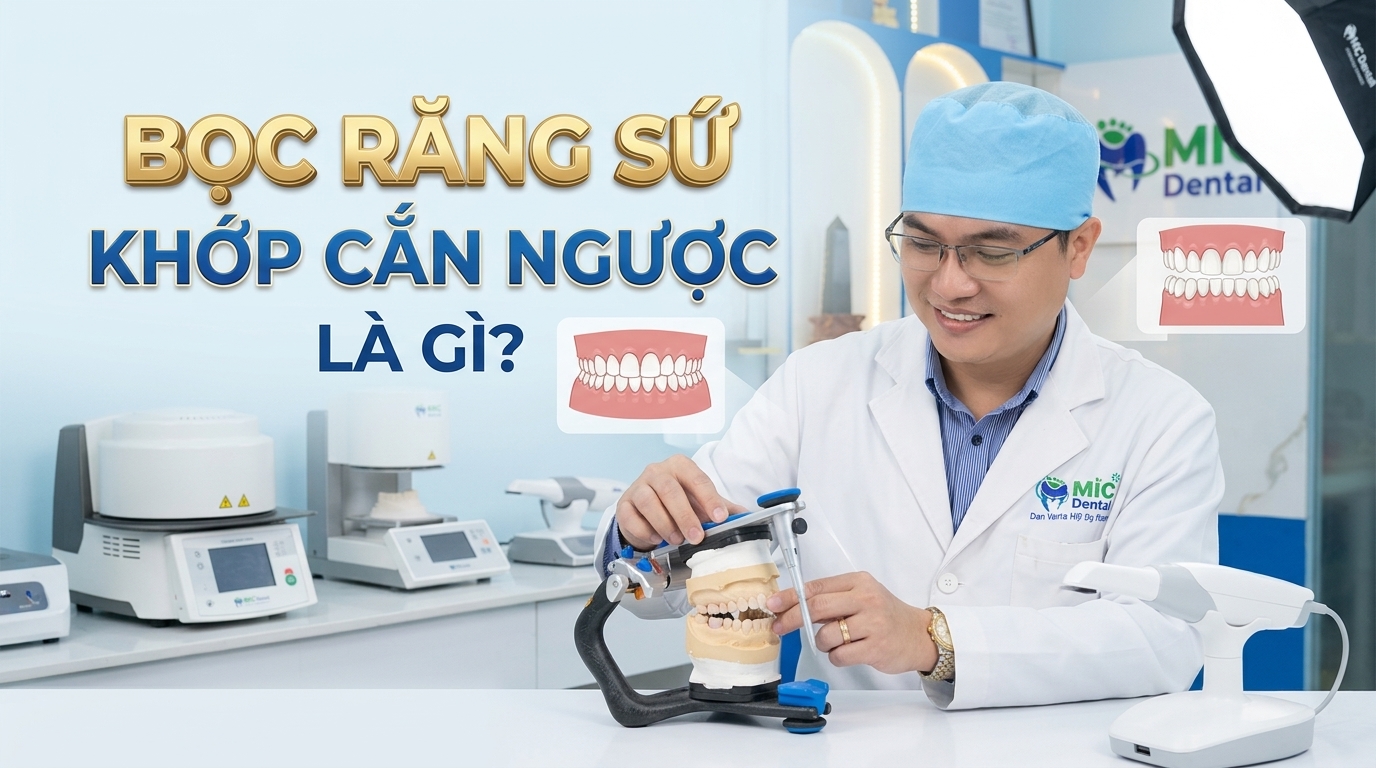 Bọc răng sứ khớp cắn ngược là gì? Chi phí và tác dụng khi thực hiện