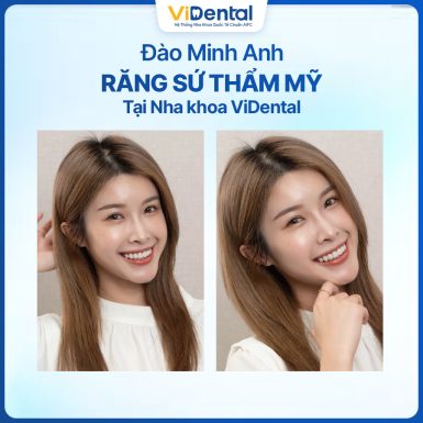 Kh&aacute;ch h&agrave;ng sử dụng dịch vụ Implant