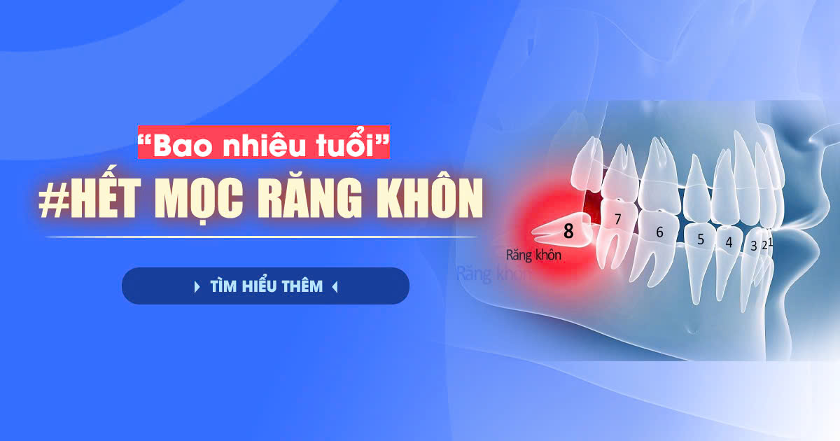 Bao Nhiêu Tuổi Hết Mọc Răng Khôn? Tìm Hiểu Thêm 1