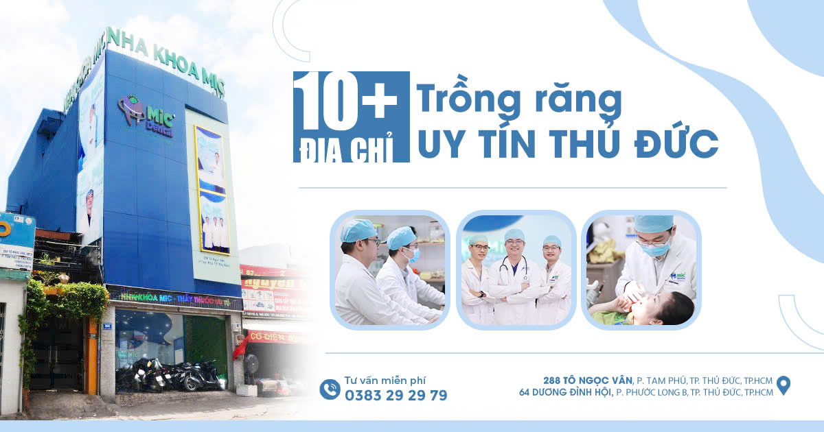 top 10 địa chỉ trồng răng implant uy tín nhất ở thủ đức