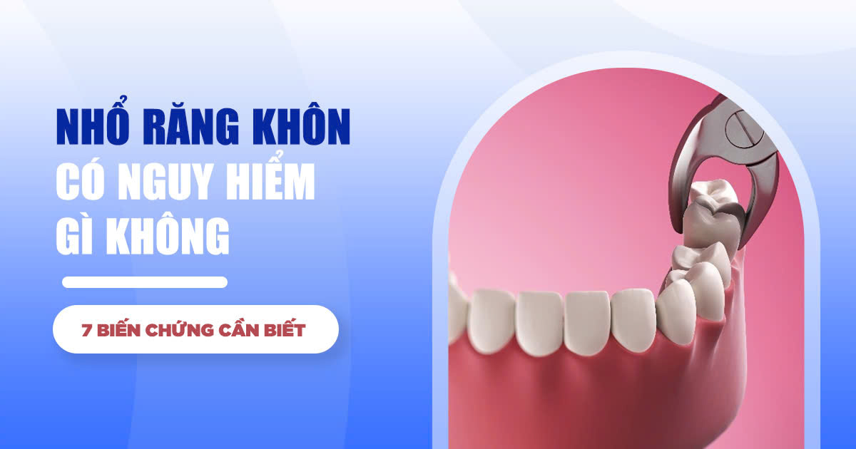 Nhổ Răng Khôn Có Nguy Hiểm Gì Không? 7 Biến Chứng Cần Biết 1