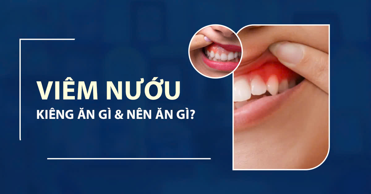 Viêm Nướu Kiêng Ăn Gì và Nên Ăn Gì? 1