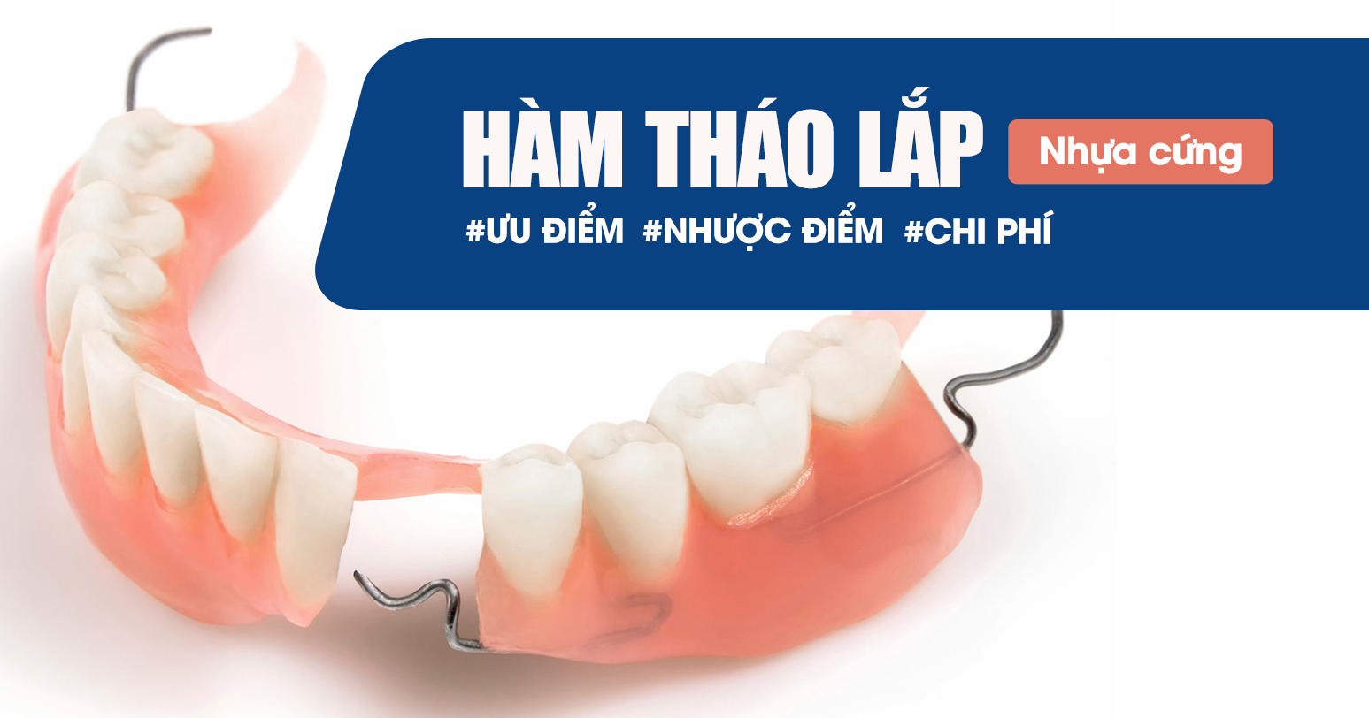 Hàm Tháo Lắp Nhựa Cứng: Ưu, Nhược Điểm và Chi Phí 1