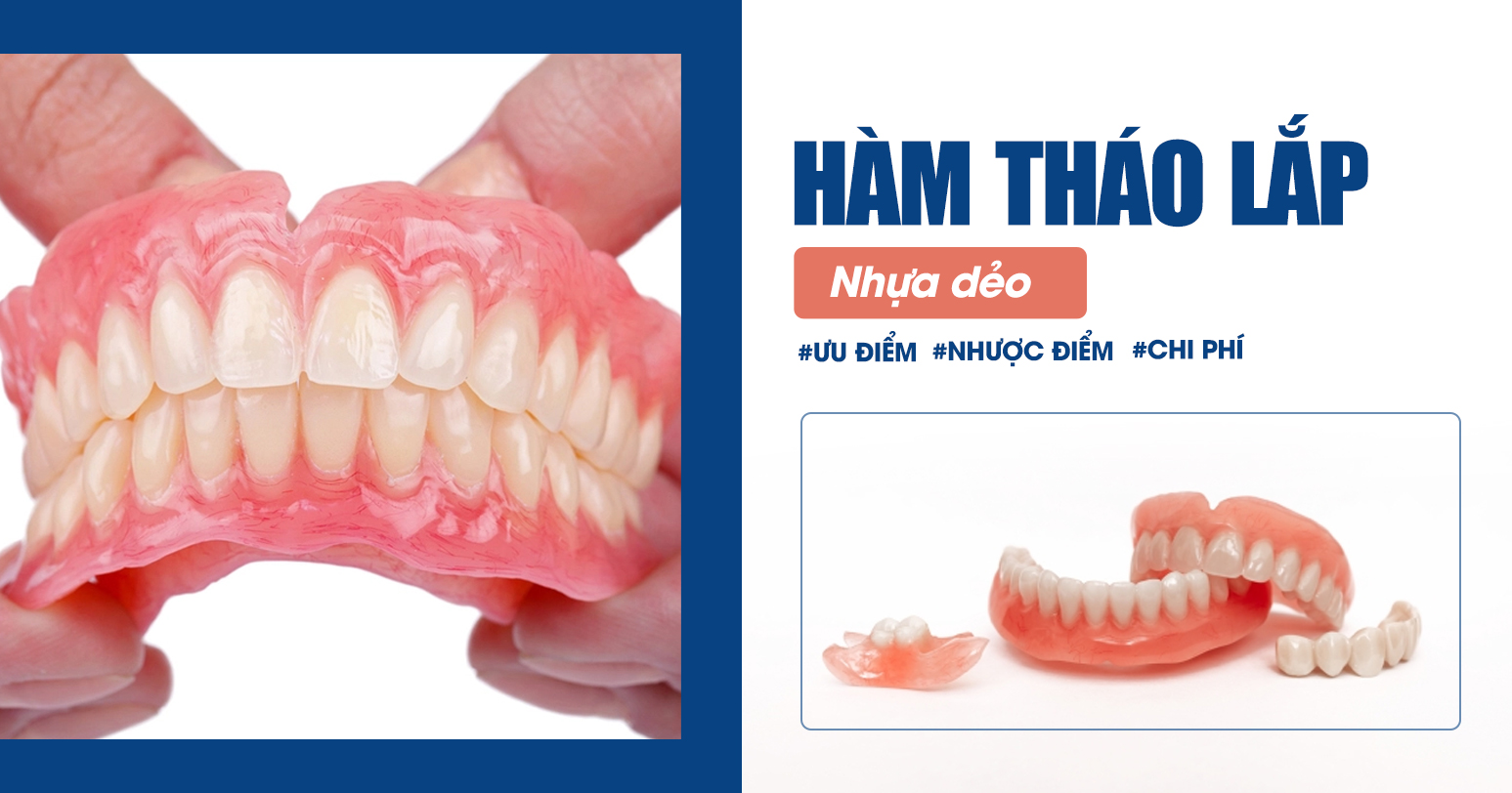 Hàm Tháo Lắp Nhựa Dẻo: Ưu, Nhược Điểm và Chi Phí 2