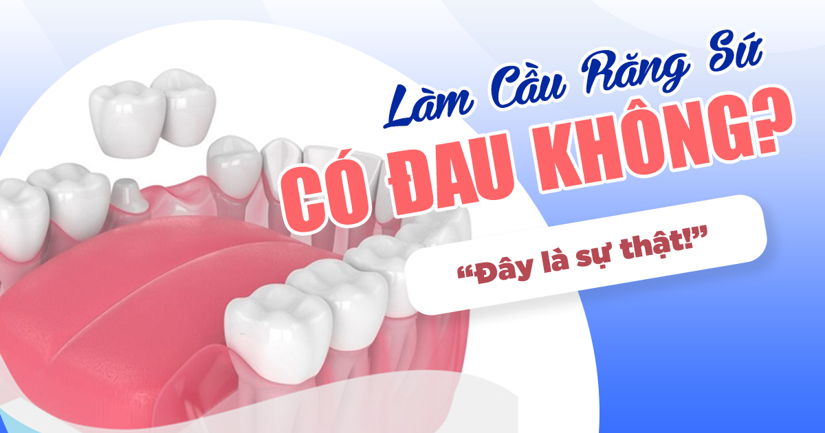 Làm Cầu Răng Sứ Có Đau Không? Đây Là Sự Thật 2
