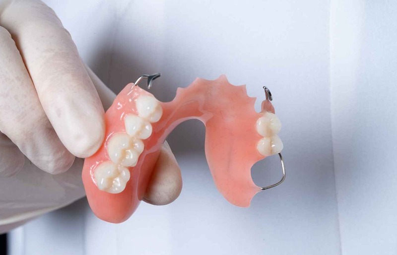 Hàm Tháo Lắp Nhựa Cứng: Ưu, Nhược Điểm và Chi Phí 4
