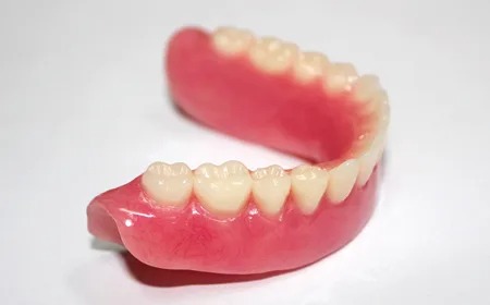 Hàm Tháo Lắp Nhựa Cứng: Ưu, Nhược Điểm và Chi Phí 3