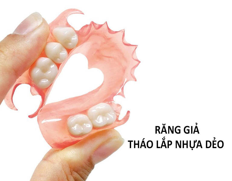 Hàm Tháo Lắp Nhựa Dẻo: Ưu, Nhược Điểm và Chi Phí 3
