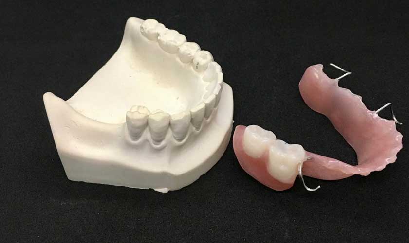 Răng Giả Tháo Lắp 2 Chiếc Có An Toàn Không? Giá Bao Nhiêu? 2