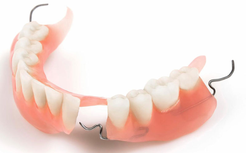Răng Giả Tháo Lắp 1 Cái Có Được Không? Quy Trình & Giá Cả 3