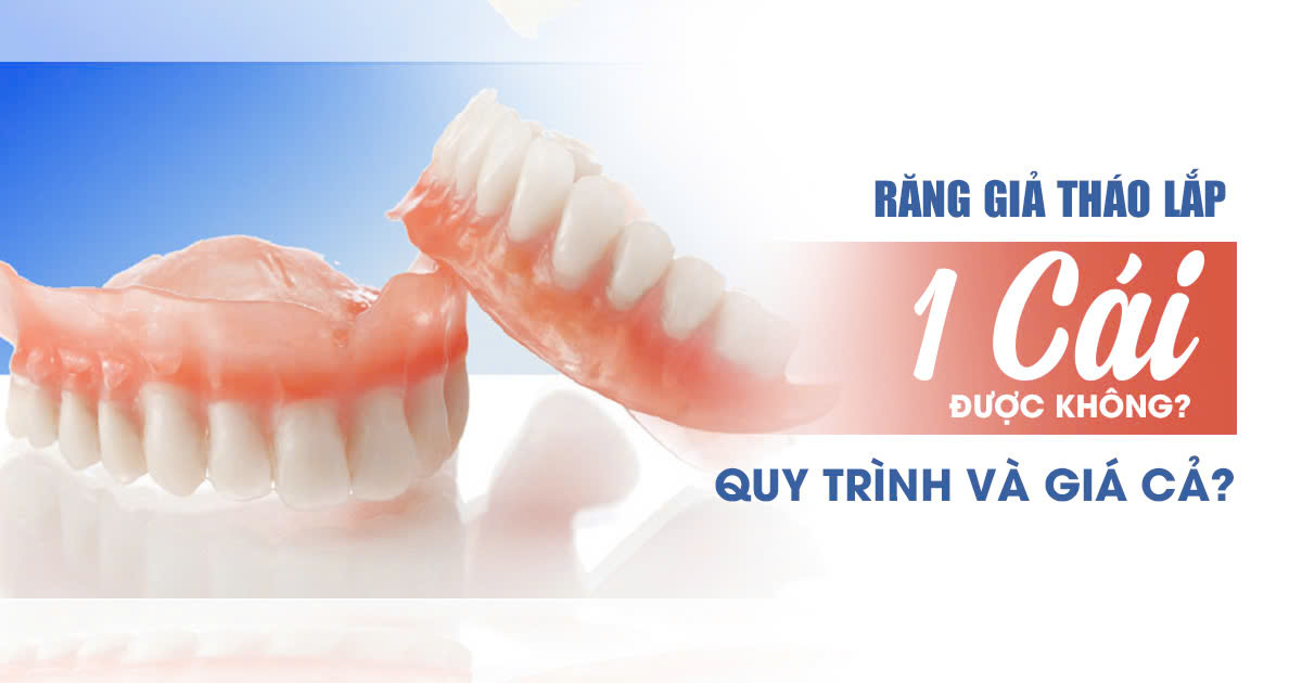 Răng Giả Tháo Lắp 1 Cái Có Được Không? Quy Trình & Giá Cả 3