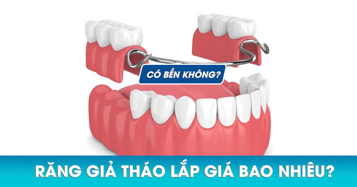 Hàm Răng Giả Tháo Lắp Giá Bao Nhiêu? Có Bền Không? 3