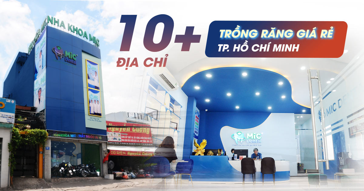 10+ Địa Chỉ Trồng Răng Implant Giá Rẻ ở TP.HCM 1