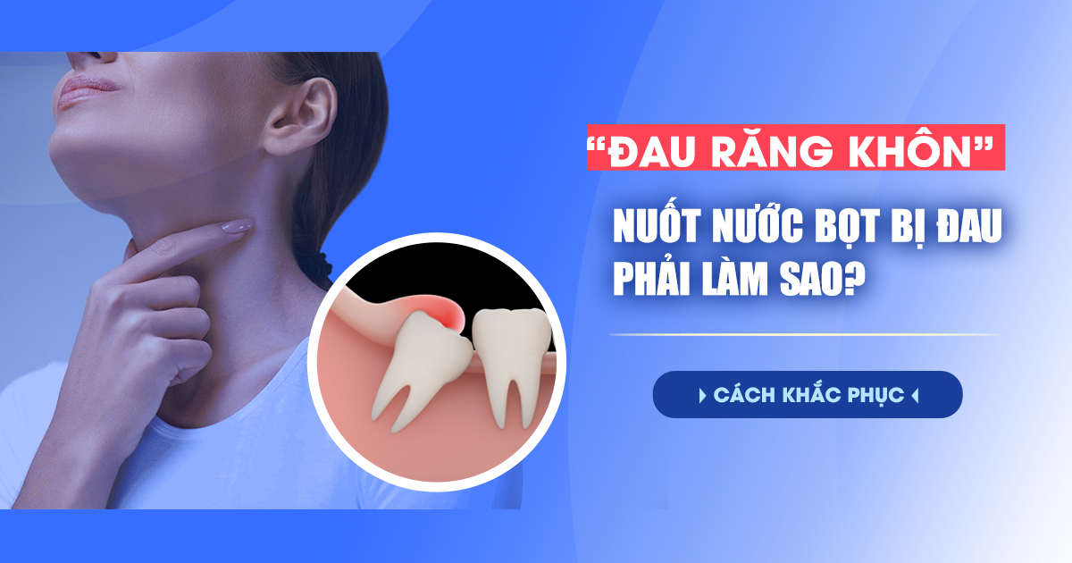 Đau Răng Khôn Nuốt Nước Bọt Đau Phải Làm Sao? Cách Khắc Phục 1
