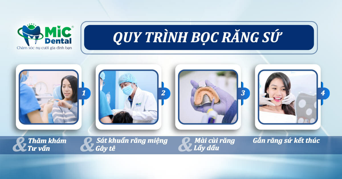 Quy trình Bọc răng sứ tại Nha Khoa MIC