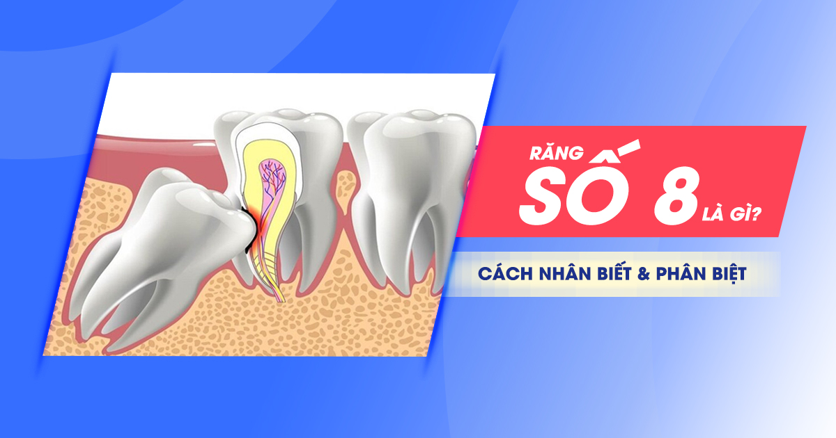 Răng Số 8 Là Răng Gì? Cách Nhận Biết và Phân Biệt 1