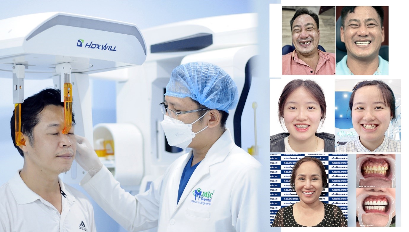 Cầu Răng Ngắt Lực Là Gì? Ưu Nhược Điểm & Khi Nào Nên Làm 3