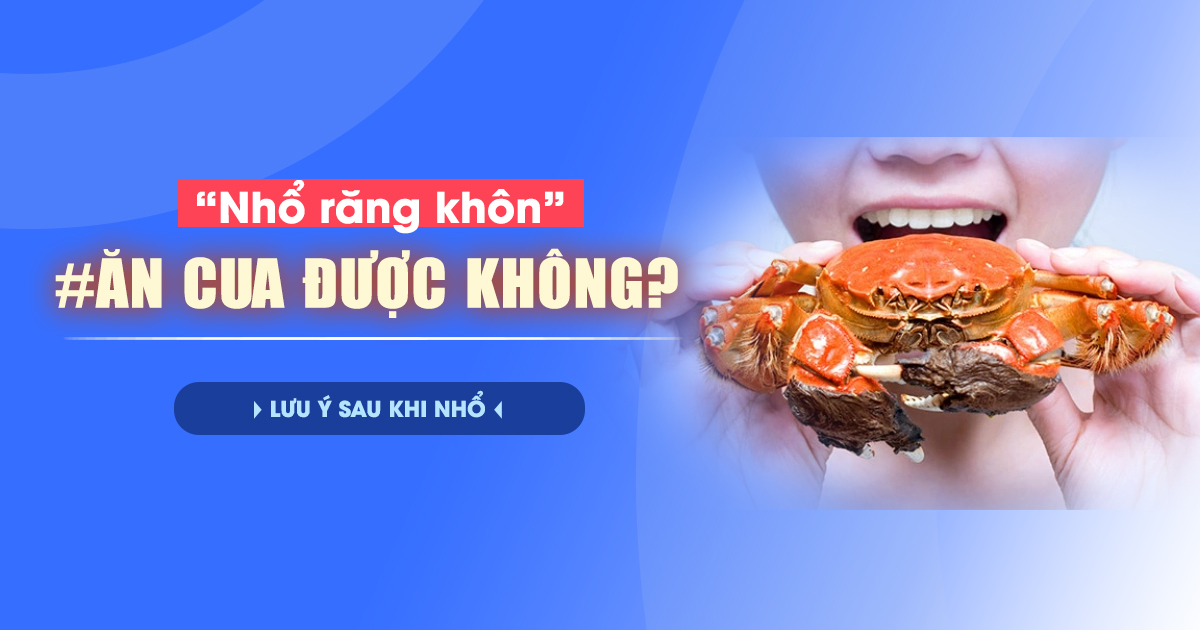 Nhổ Răng Khôn Ăn Cua Được Không? Lưu Ý Sau Khi Nhổ 1