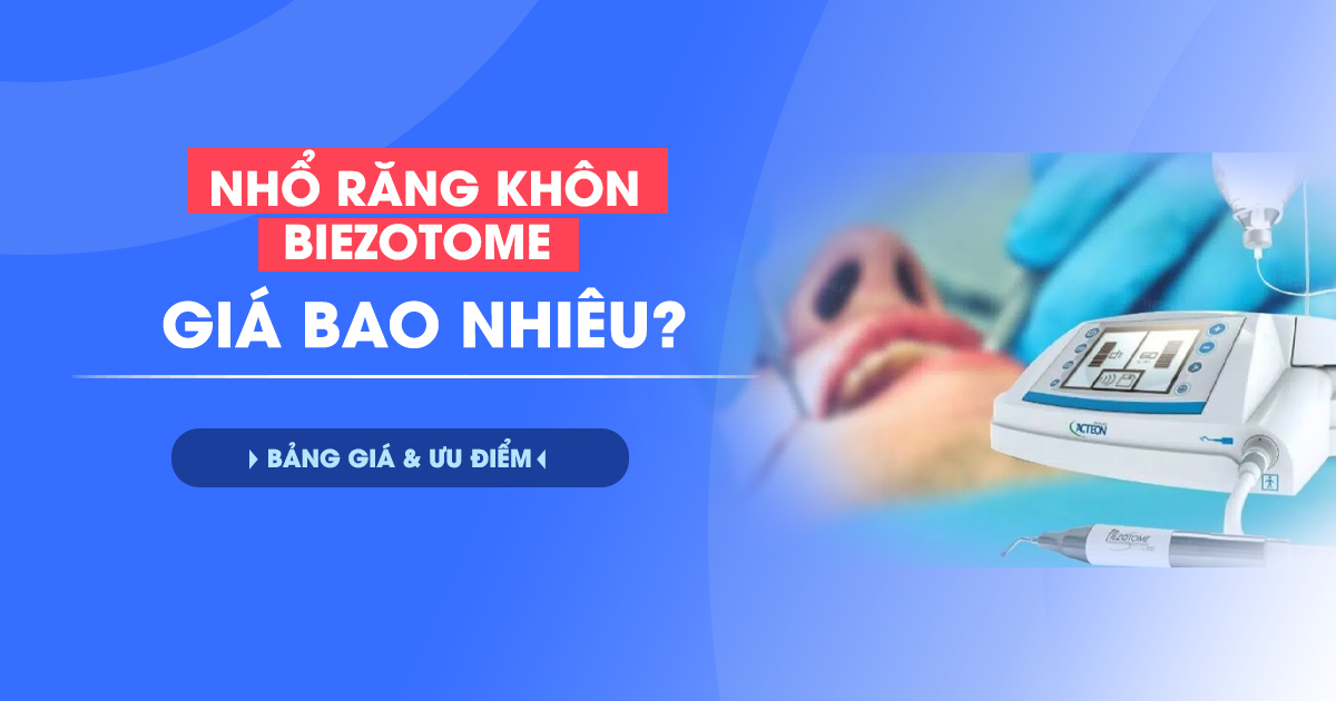 Nhổ Răng Khôn Piezotome Giá Bao Nhiêu? Bảng Giá & Ưu Điểm 4