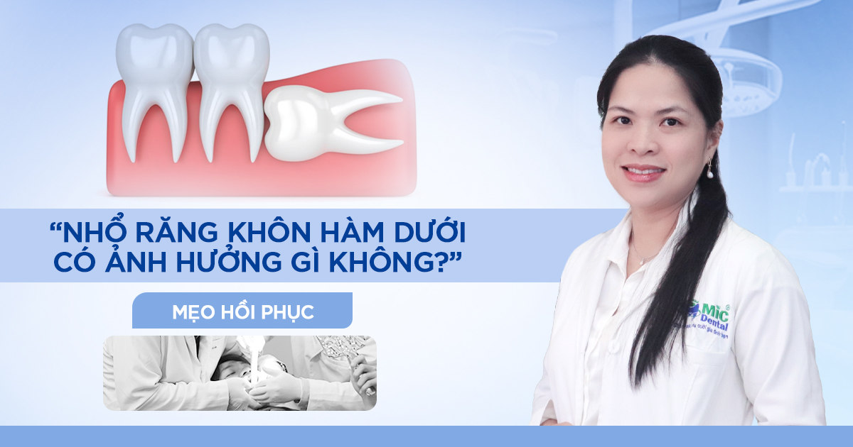 Nhổ Răng Khôn Hàm Dưới Có Ảnh Hưởng Gì Không? Mẹo Hồi Phục 1