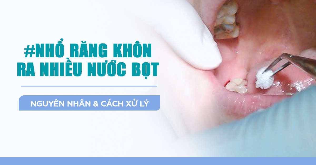 Nhổ Răng Khôn Ra Nhiều Nước Bọt: Nguyên Nhân & Cách Xử Lý 2
