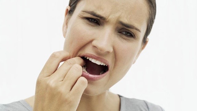 Mọc Răng Khôn Bị Hôi Miệng: 5 Cách Xử Lý 2