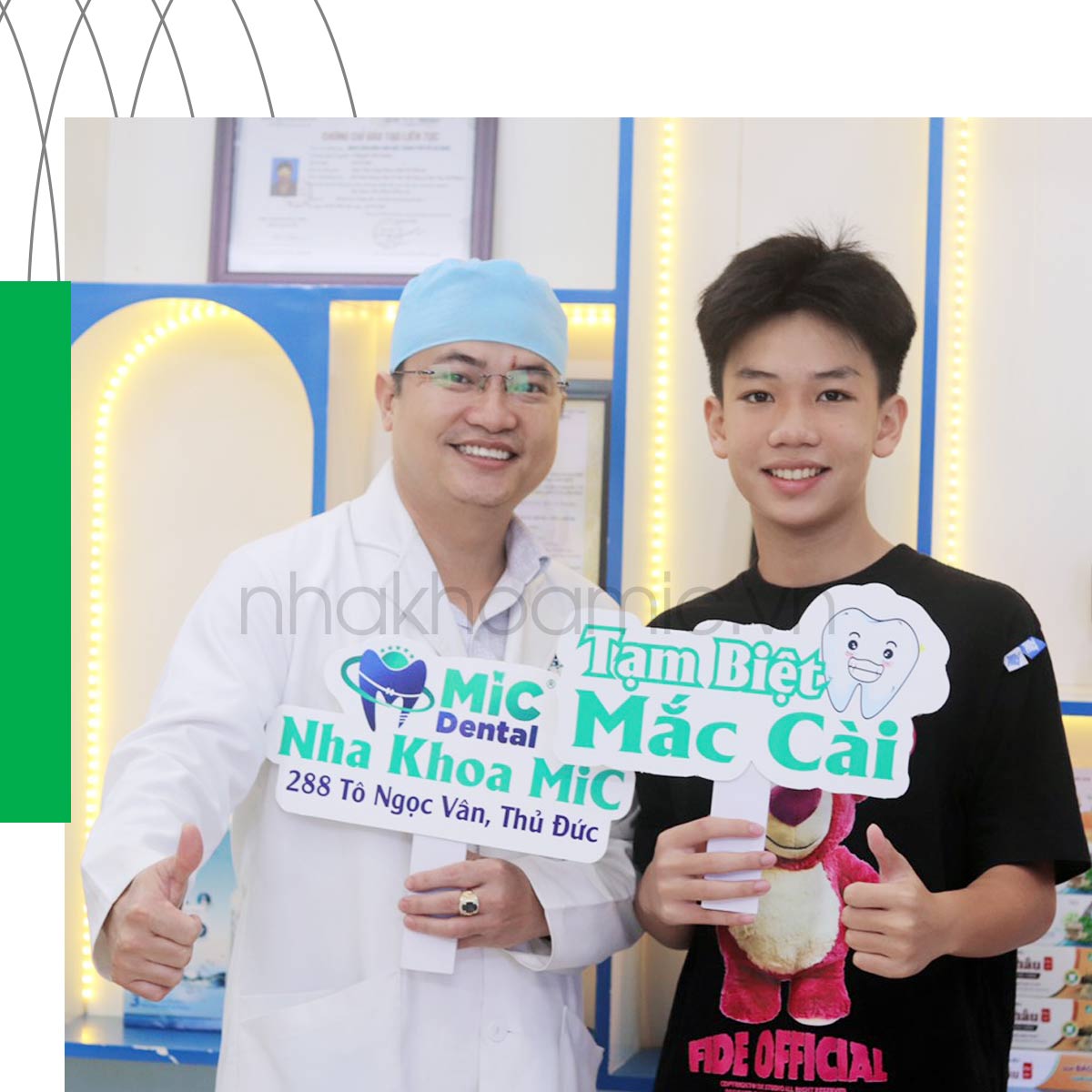 Thời gian chờ lý tưởng để niềng răng