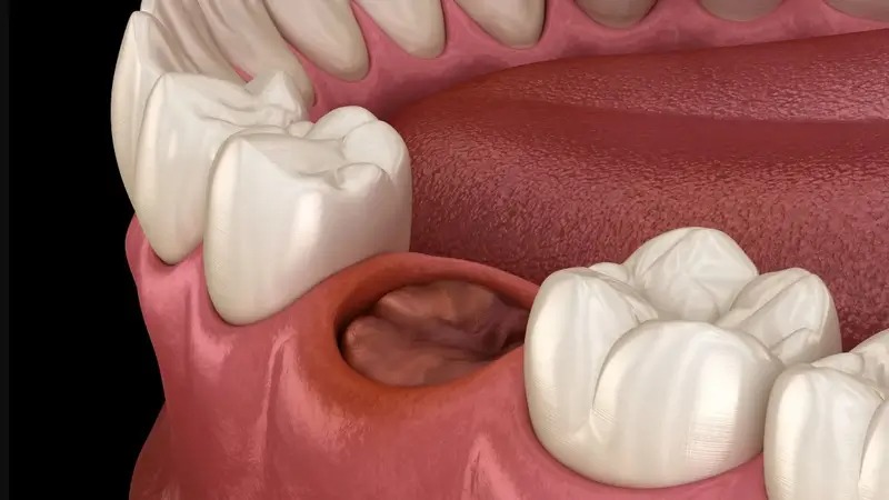 Vì sao hút thuốc lá dễ gây viêm ổ khô