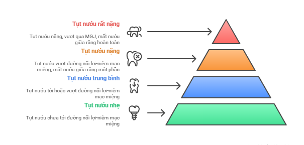 Phân loại Miller gồm những cấp độ nào