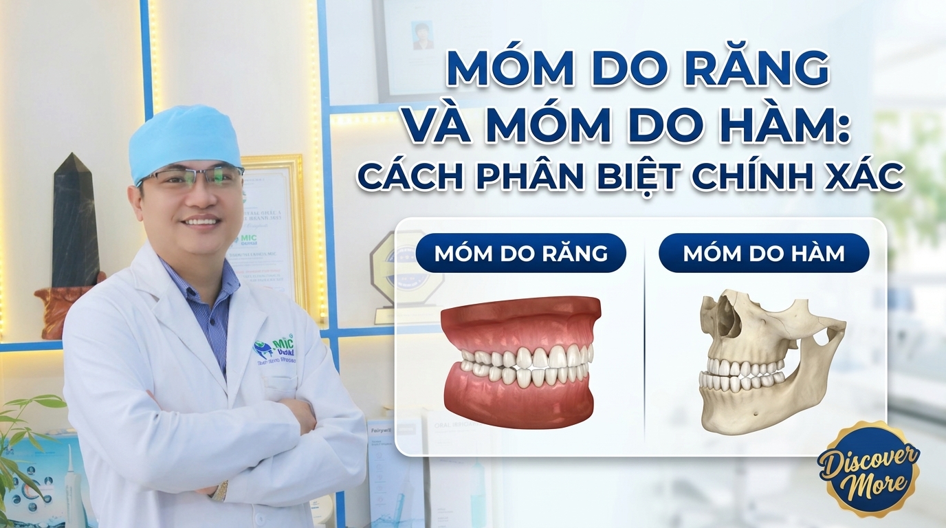 Móm Do Răng Và Móm Do Hàm: Cách Phân Biệt Chính Xác