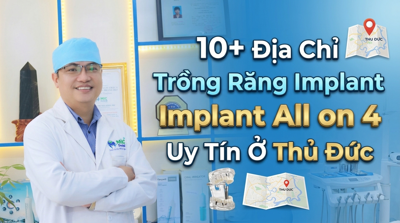 10+ Địa Chỉ Trồng Răng Implant All on 4 Uy Tín Ở Thủ Đức