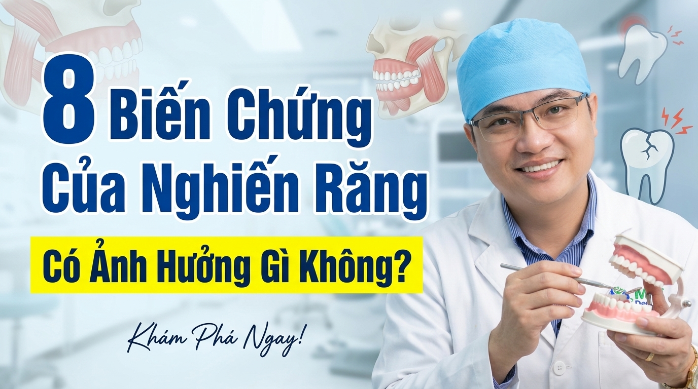 8 Biến Chứng Của Nghiến Răng Có Ảnh Hưởng Gì Không?