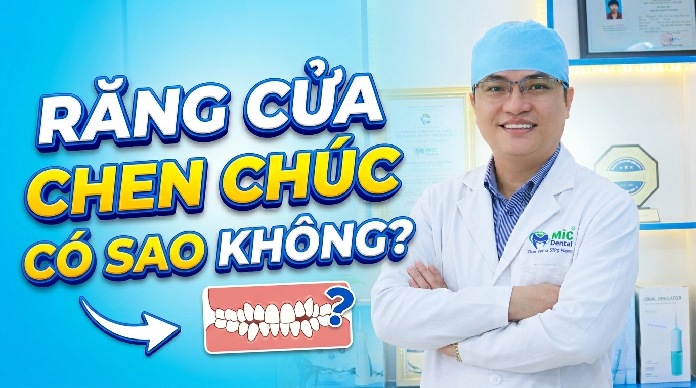 Răng Cửa Chen Chúc Có Sao Không? Cách Xử Lý Theo Từng Mức Độ