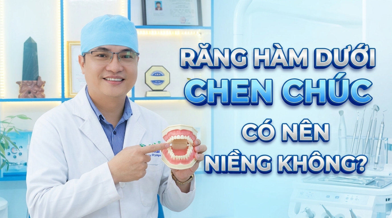 Răng Hàm Dưới Chen Chúc Có Nên Niềng Không? Giải Pháp Tối Ưu