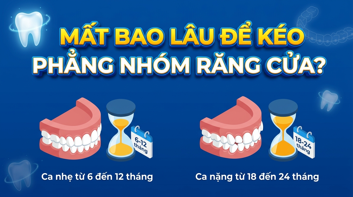Mất Bao Lâu Để Kéo Phẳng Nhóm Răng Cửa?
