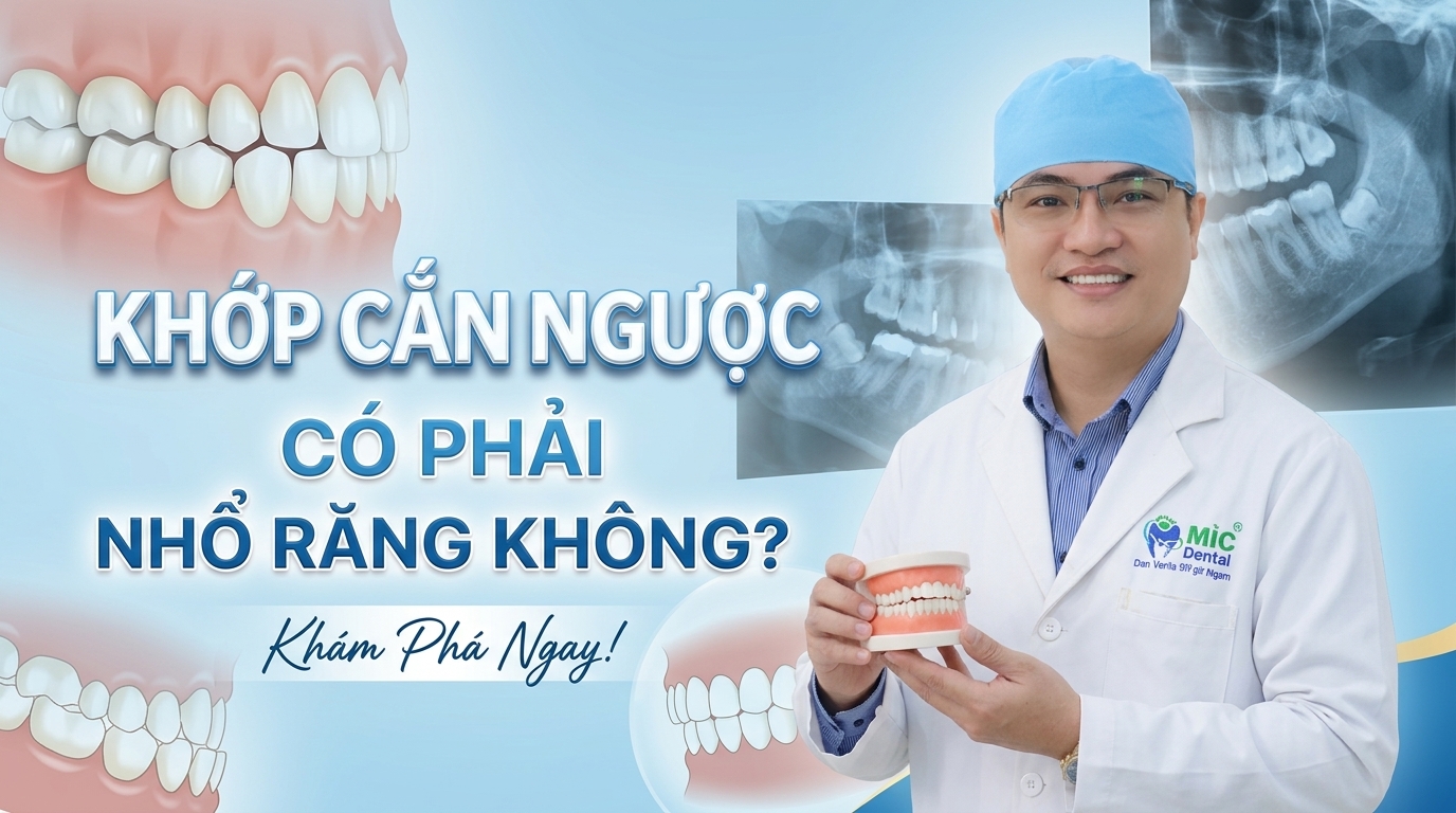 Khớp Cắn Ngược Có Phải Nhổ Răng Không? Khi Nào Cần Khí Cụ Nong Hàm?