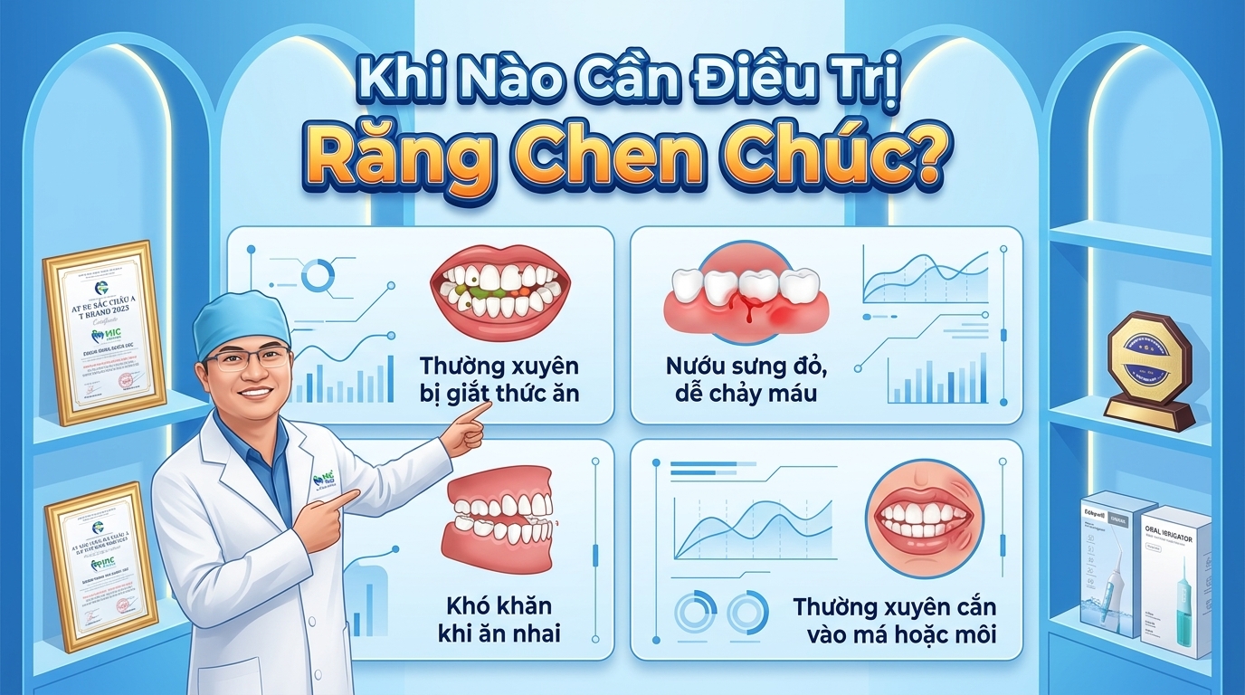 Khi Nào Cần Điều Trị Răng Chen Chúc?