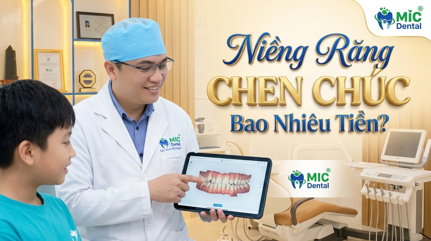 Niềng Răng Chen Chúc Bao Nhiêu Tiền? Bảng Giá Chi Tiết