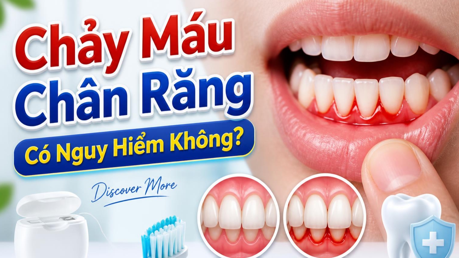 Chảy Máu Chân Răng Có Nguy Hiểm Không? Khi Nào Cần Khám?