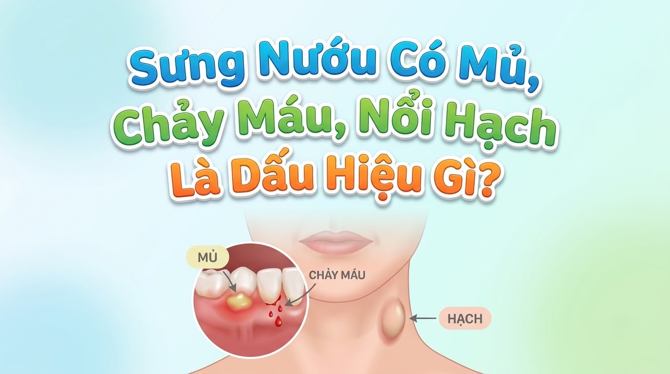 Sưng Nướu Có Mủ, Chảy Máu, Nổi Hạch Là Dấu Hiệu Gì?