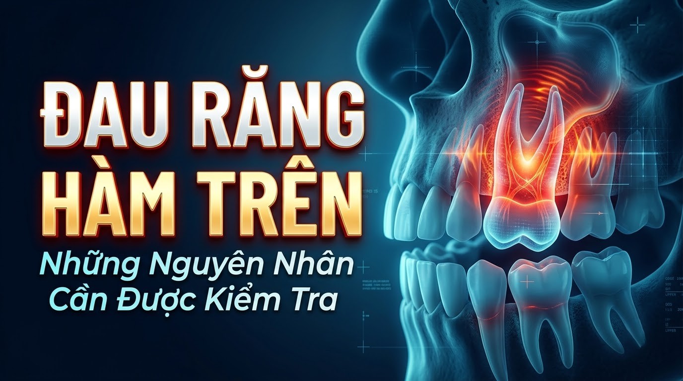 Đau Răng Hàm Trên: Những Nguyên Nhân Cần Được Kiểm Tra
