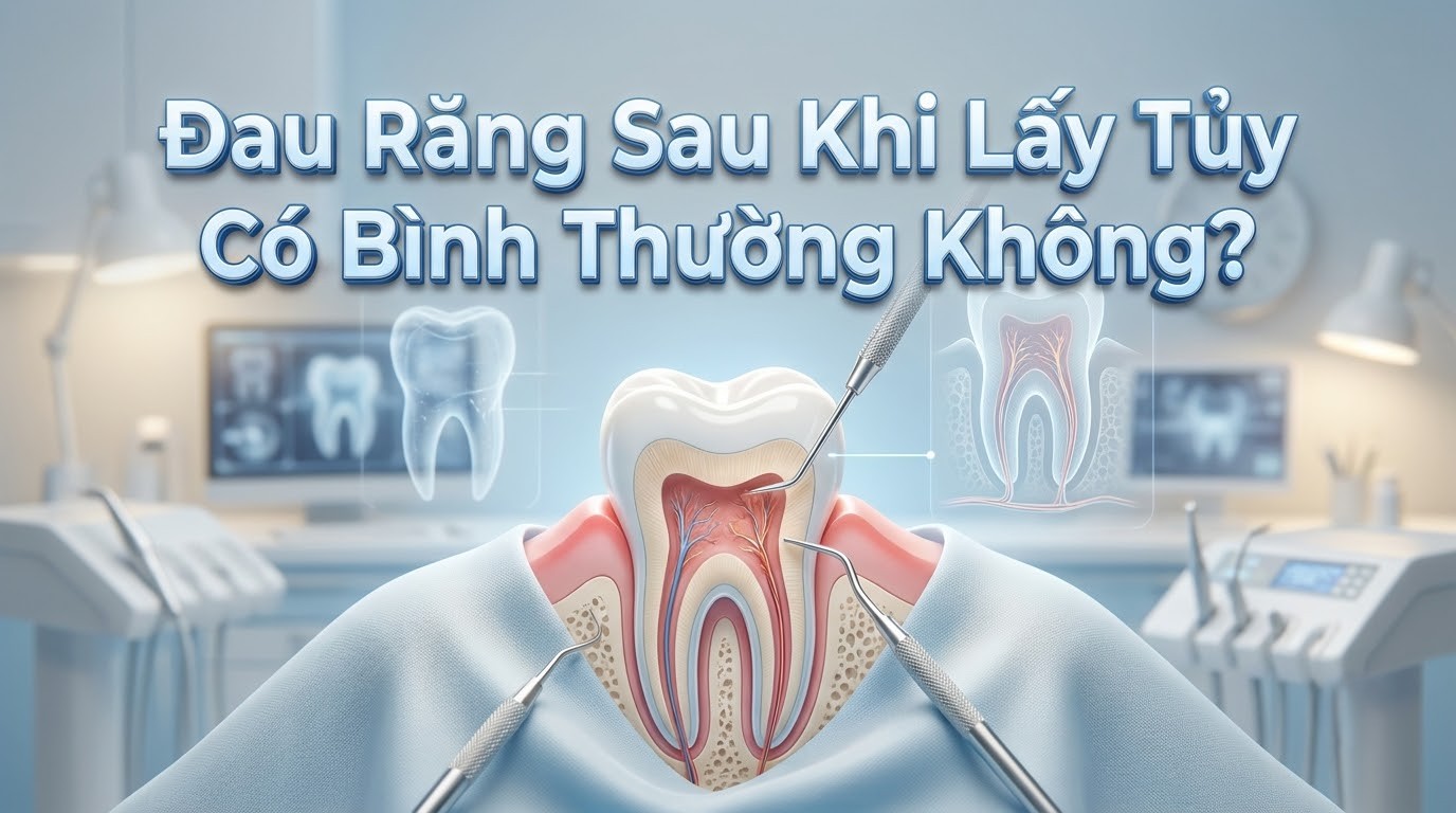 Đau Răng Sau Khi Lấy Tủy Có Bình Thường Không?