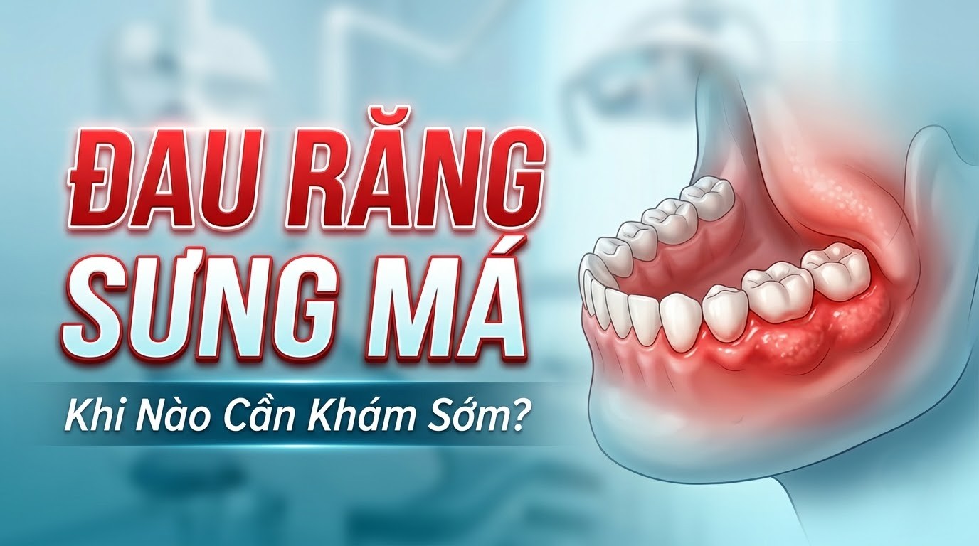 Đau Răng Sưng Má: Khi Nào Cần Khám Sớm?